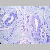 Pancreas SF 15.jpg